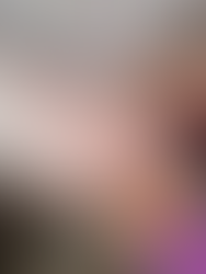 Patah tangan tersepit di mesin simen