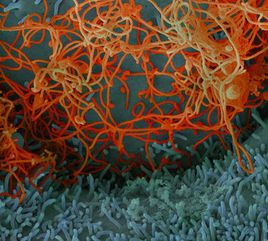 Recent Bioinformatics grad, Emily Speranza from the Connor Lab, was featured in BU Today for their w