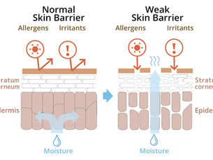 Stop Treating Your Skin Like a Type. Start Treating It Like a State.