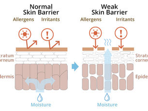 Stop Treating Your Skin Like a Type. Start Treating It Like a State.