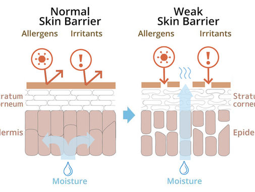 Stop Treating Your Skin Like a Type. Start Treating It Like a State.