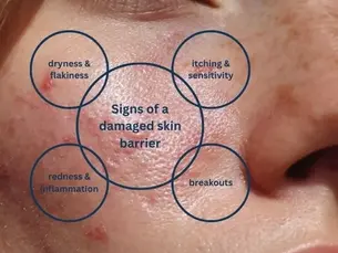 Korea 2 Cape Town Calm & Reset Skin Kit barrier repair Korean skincare routine for sensitive reactive skin