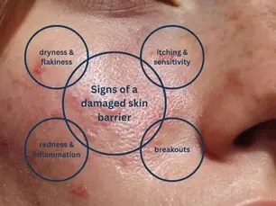 Korea 2 Cape Town Calm & Reset Skin Kit barrier repair Korean skincare routine for sensitive reactive skin