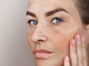 Pigmentation Correction Kit vitamin C and rice serums, Korea 2 Cape Town K-beauty for dark spots and uneven tone