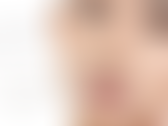 Rosacea relief Korean skincare kit for redness-prone sensitive skin – Korea2CapeTown