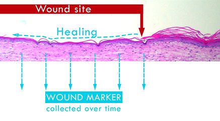 Wound Healing model 2 copy.jpg