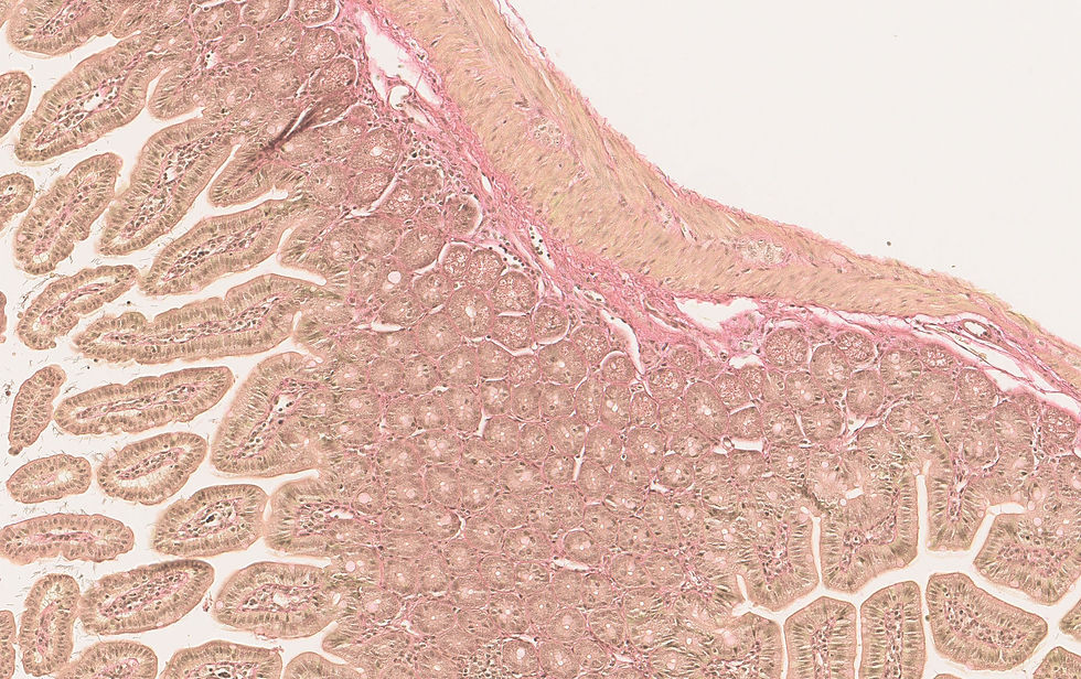 Sirius Red staininig on Intestine. Fibres stained with dark-red.