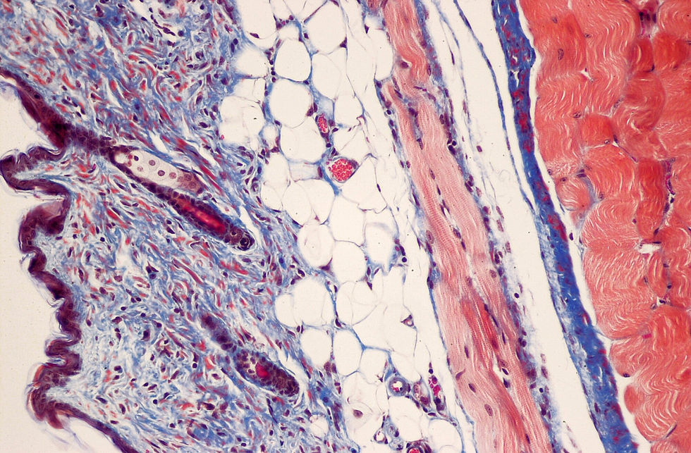 Skin tissue stained with MTC