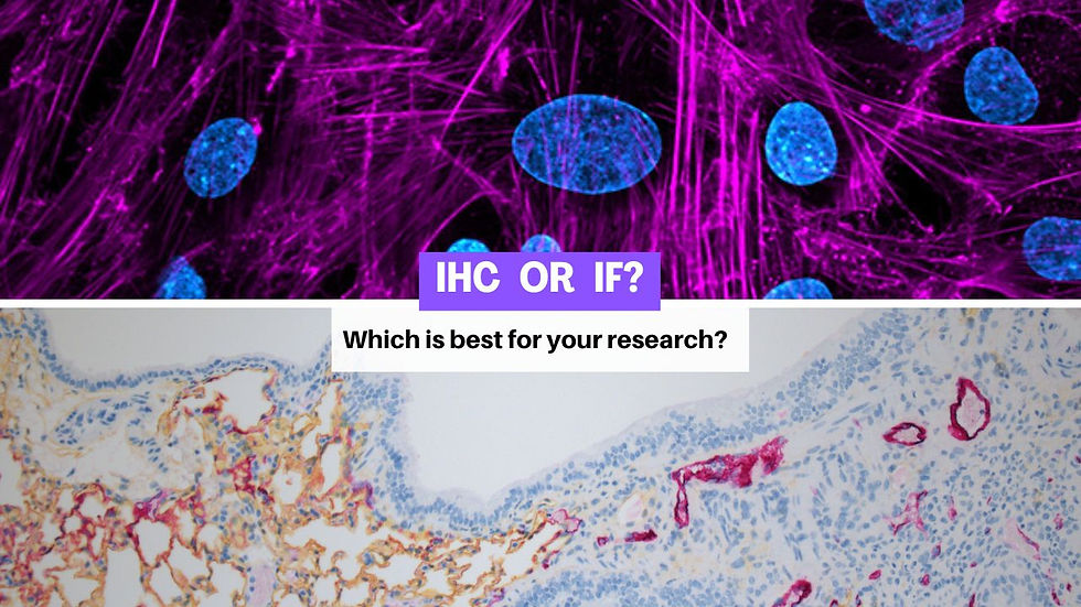 IHC vs IF: Which Is Better for Your Tissue Research?