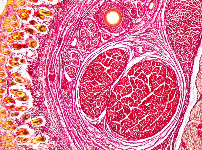 Tissue stained with Sirius Red