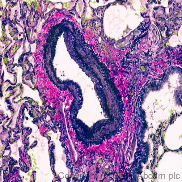 Blood vessel stained with EVG
