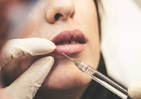 The Rise of Non-Invasive Aesthetic Treatments