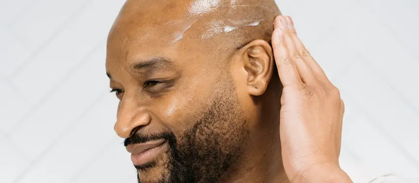 The Rise Of Intentional Baldness As A Statement Of Personal Style