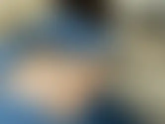 எபிடியூரல் சிசேரியன் ஊசி