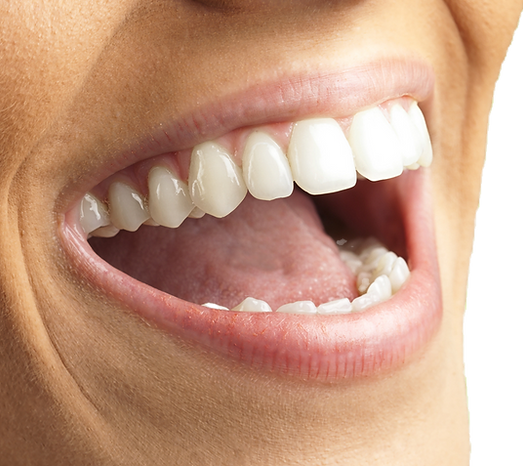 Women with perfect white teeth promoting Portwall Care plan