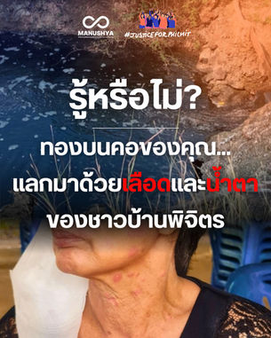 “เพราะทองบนคอของคุณ... แลกมาด้วยเลือดและน้ำตาของชาวบ้านพิจิตร”