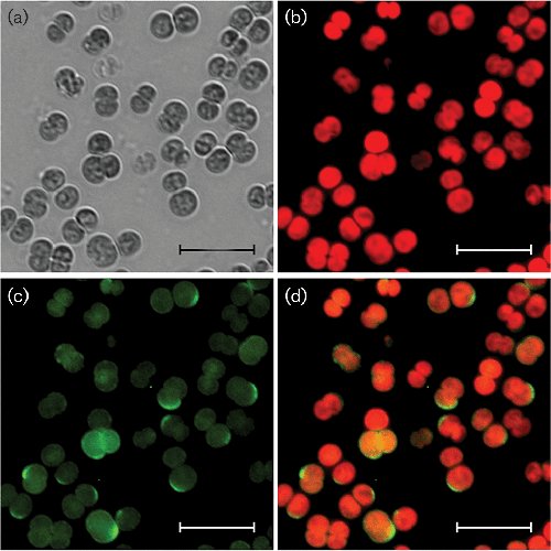 Localisation of GFP-tagged proteins in Synechocystis sp. PCC 6803