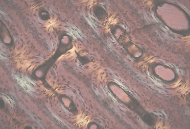 mystery_bone_flb90_nic20x_edited_edited_