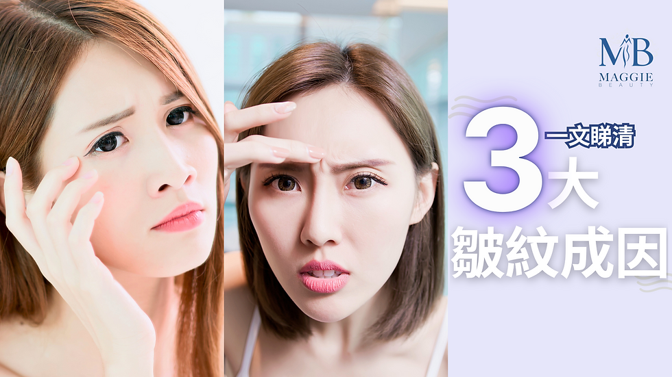 3大皺紋成因