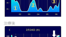 一目瞭然【鍼灸治療による睡眠改善の効果】