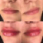 resultados de pacientes