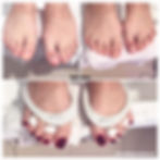 Ayak Medikal Protez Tırnak