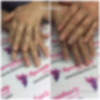 Tırnak yeme sorunu çözümü