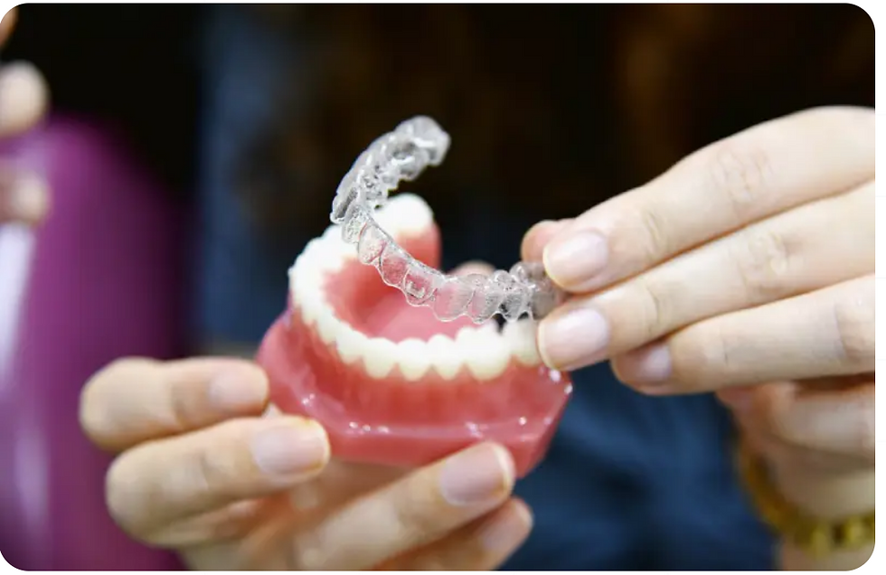 Invisalign tedavisi sırasında kullanılan kişiye özel şeffaf plak görseli