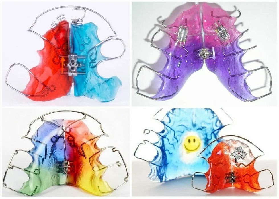 Çocuğun ağzında sabit bir yer tutucu gösteren görsel.