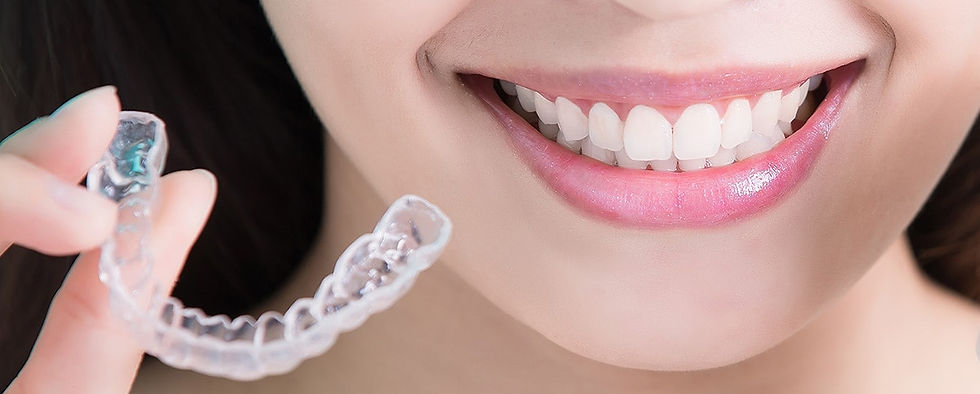 Invisalign tedavisi sırasında kullanılan kişiye özel şeffaf plak görseli