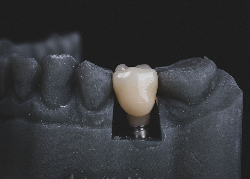 Diş implantı çene kemiğine yerleştirilirken uygulama görüntüsü