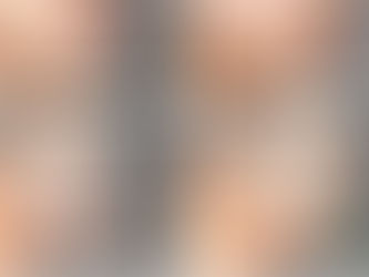 Çene Cerrahisi (Ortognatik Cerrahi) Nedir? Nasıl Uygulanır?