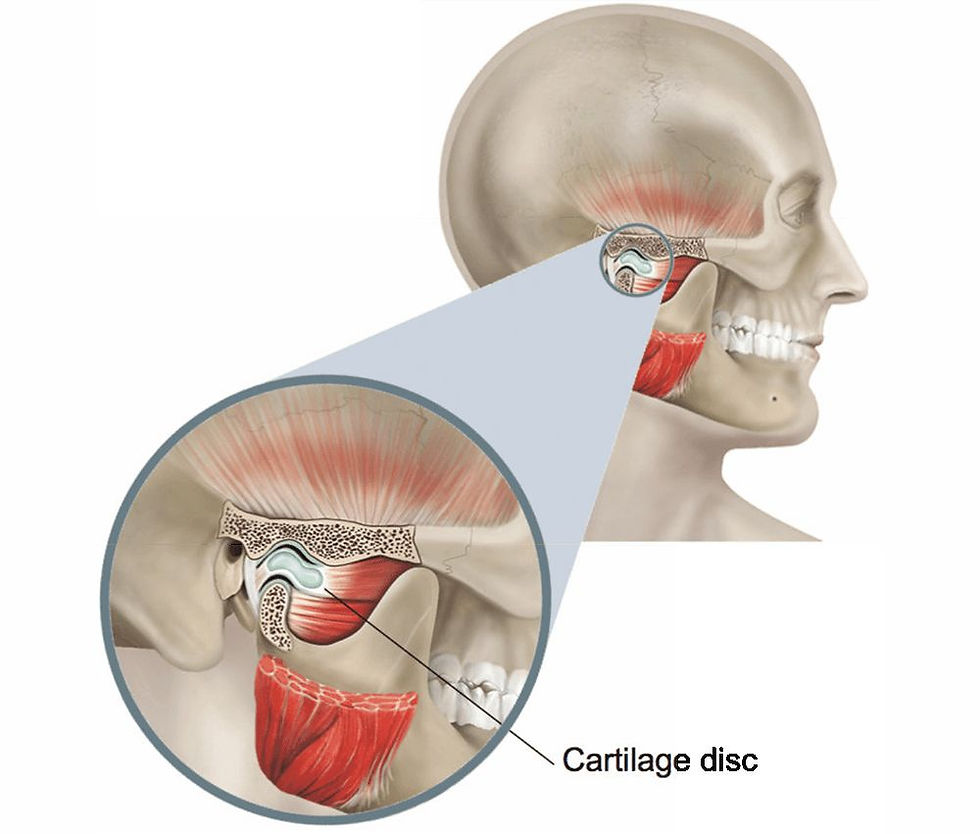 TMJ eklem bölgesinin anatomik görseli.