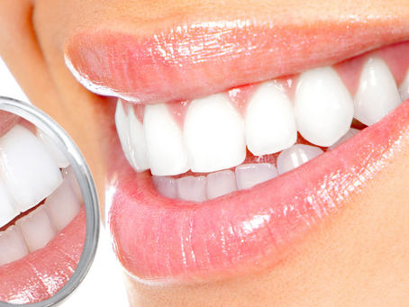 Beyazlatma Uygulaması: Oran Çankaya Ankara’da Diş Renk Tonunu Açmaya Yönelik Çözümler