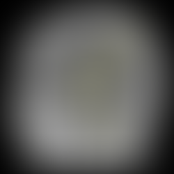 Deficiencia de GH: diagnóstico bioquímico avanzado