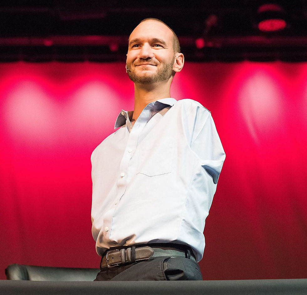 Nick, celebrated pastor, born without arms and legs