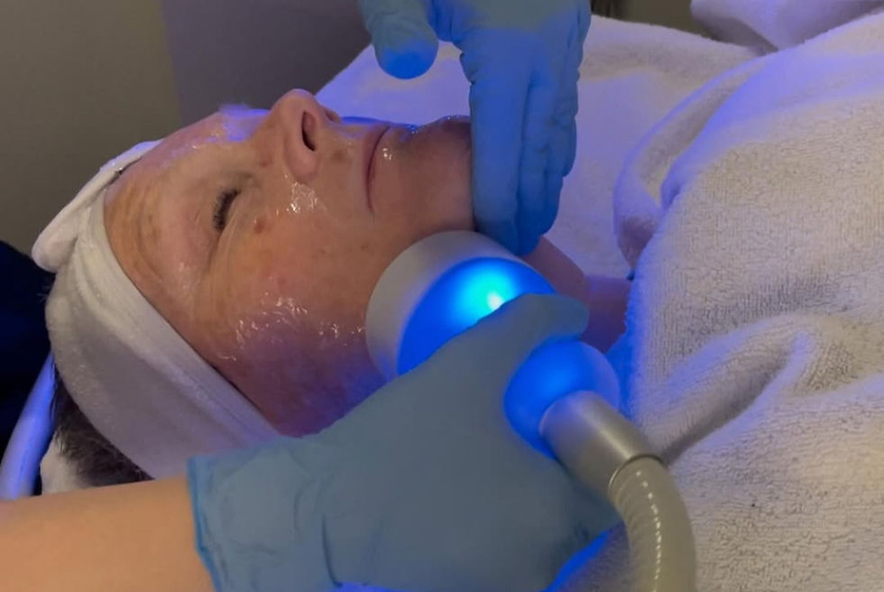 Cryoskin Face Treatment being done on a woman