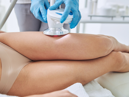 4 Reasons to Book Your Free CoolSculpting Consult at Market Mall Dermatology Clinic in Calgary Today
