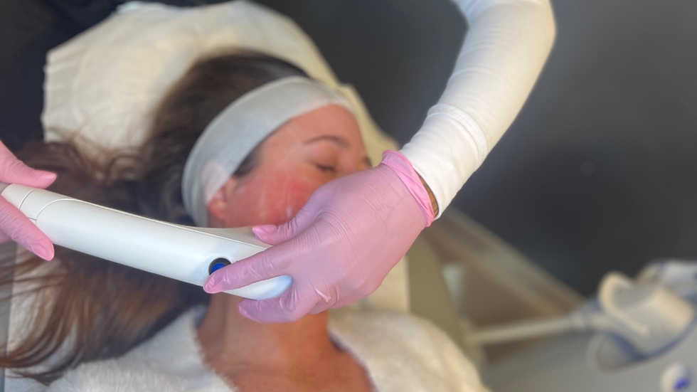 Sofwave at Market Mall Dermatology in Calgary, AB