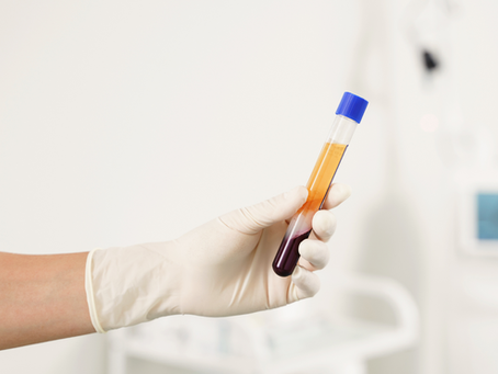 What Is PRP and How Does It Work?