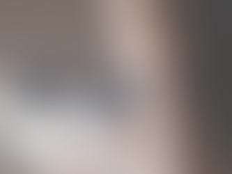 The Secret to Financing Your Dream Skin Without Impacting Your Credit Score