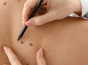 May: Skin Cancer Awareness Month