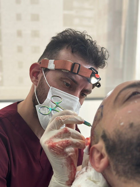 UltraHairTransplant
