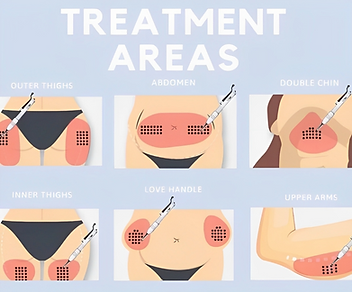 Laser Lipo Treatment | Best Laser Liposuction Near Me