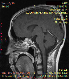 GA-pst-sag-IMG-0001-00010