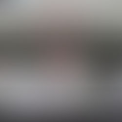 毛周期の影響を受けない脱毛器導入店は少ないです！