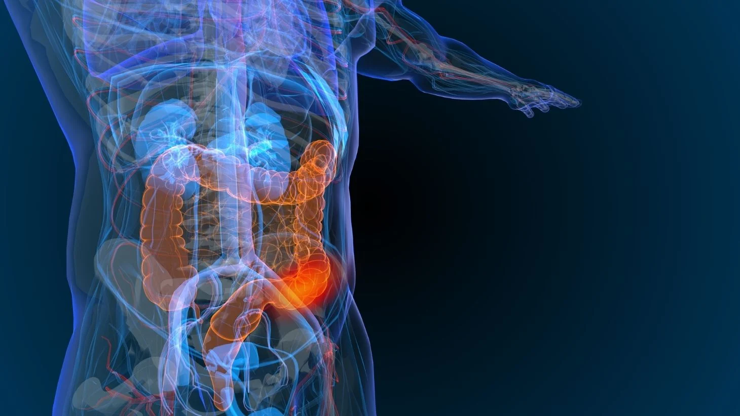 WVCI - t Treating Colorectal Cancer and Other GI Cancers.webp