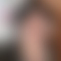 שינויים בהרגלי ההליכה