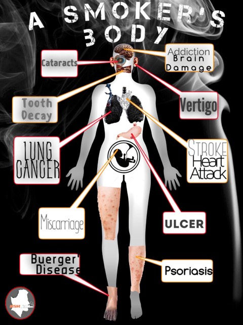 A Smoker's Body