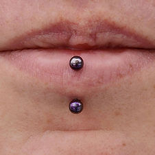 Healed Vertical Labret with Purple Anodized Curved Barbell